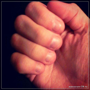 Последствия вредных привычек: перестаем грызть ногти