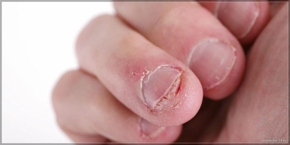 Профилактика болезней ногтей
