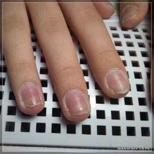 Профилактика болезней ногтей на руках